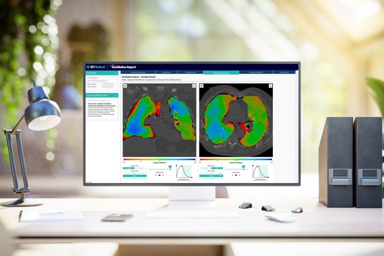 4DMedical Healthcare Software XVLVAS CaseStudy Header